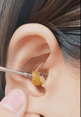 Σετ Εργαλεία Καθαρισμού Αυτιών - Glamza 6pc Ear Wax Removal Kit Πως να ξεβουλώσω το αυτί μου