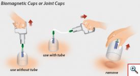 Παραδοσιακή Θεραπευτική Συσκευή με Βεντούζες 6 Ανταλλακτικών Κεφαλών