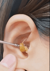 Σετ Εργαλεία Καθαρισμού Αυτιών - Glamza 6pc Ear Wax Removal Kit Πως να ξεβουλώσω το αυτί μου Σετ Εργαλεία Καθαρισμού Αυτιών - Glamza 6pc Ear Wax Removal Kit Πως να ξεβουλώσω το αυτί μου