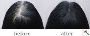 Beaver Hair Building Fibers, Μικρο-ίνες Φυσικής Κερατίνης κατά της Τριχόπτωσης & Αραίωσης των Μαλλιών 12γρ