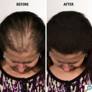 VolumON Hair Building Fibers, Μικρο-ίνες Φυσικής Κερατίνης κατά της Τριχόπτωσης & Αραίωσης των Μαλλιών 12γρ