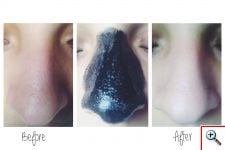 Black Mask - Μαύρη Μάσκα Προσώπου για Καθαρισμό από Μαύρα Στίγματα SkinaPeel 50ml