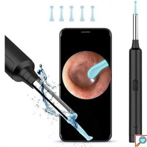 ANDOWL Επαναφορτιζόμενο Ωτοσκόπιο Wi-Fi USB με Κάμερα και Φακό LED - Intelligent Otoscope Q-ES1