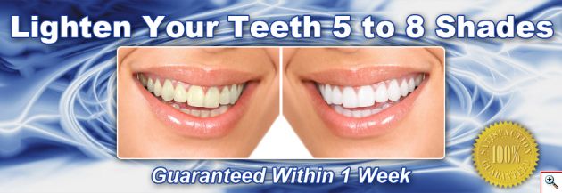 Επαγγελματικό Σύστημα Λεύκανσης Δοντιών SmileBright + Plasma Light